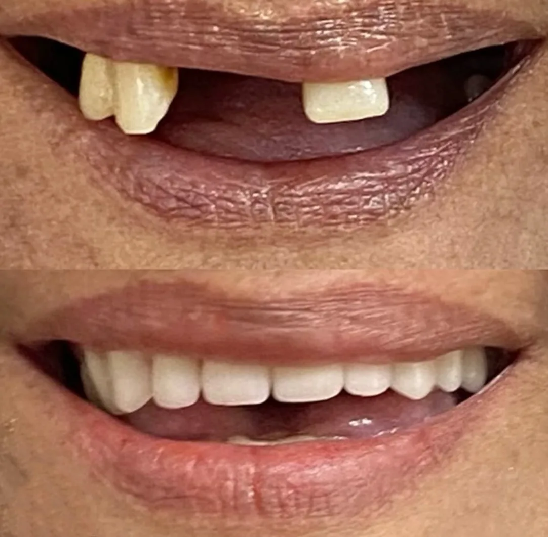 Caso real de tratamento — antes e depois