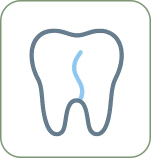 Tratamento de Canal (Endodontia)