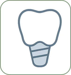 Implantes Dentários